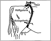 Hüftfessel für beide Hinterläufe